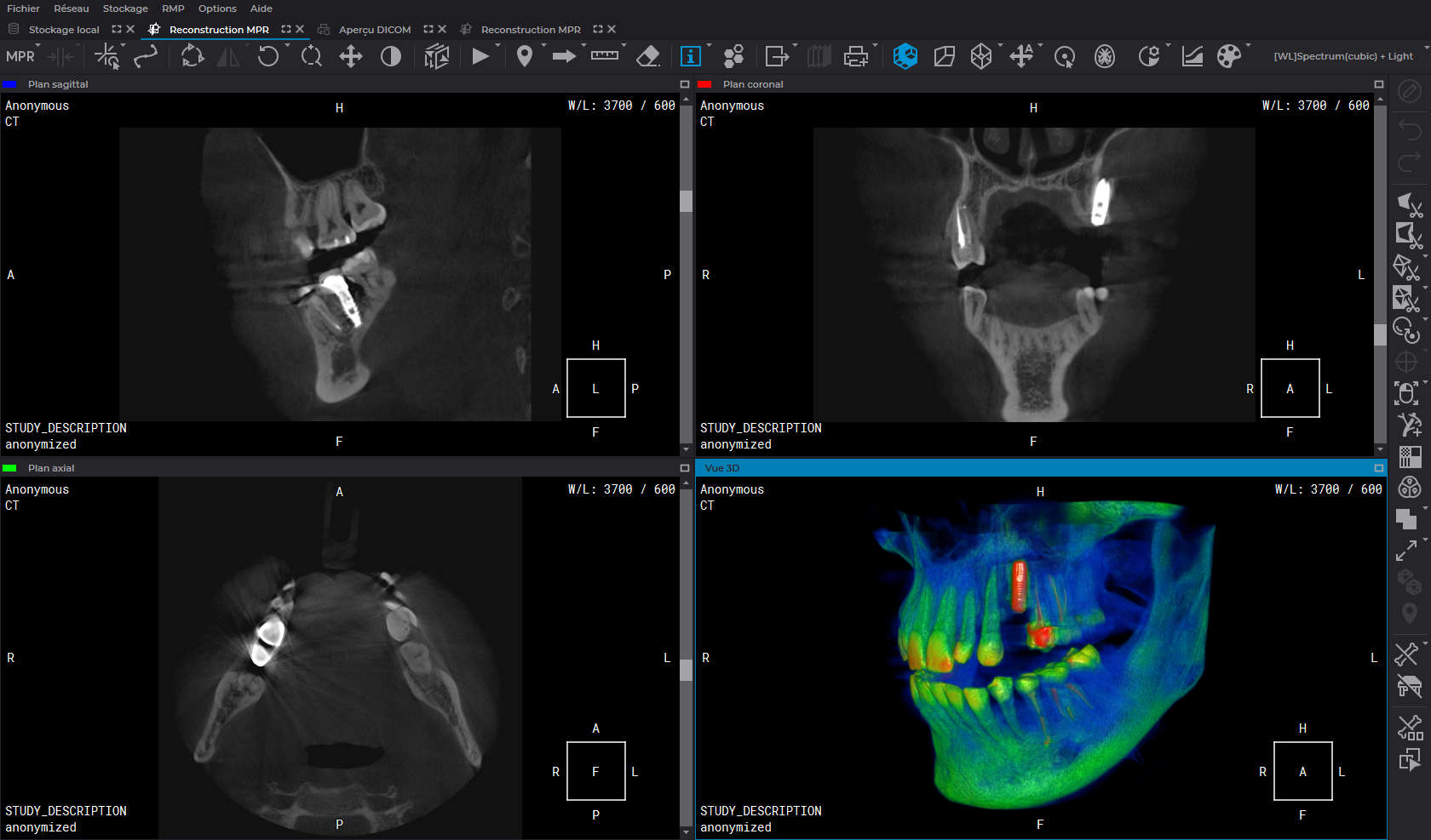 inobitec viewer lite photo